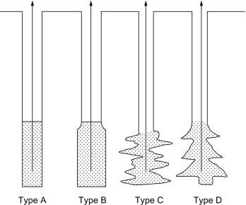 types of micropiles